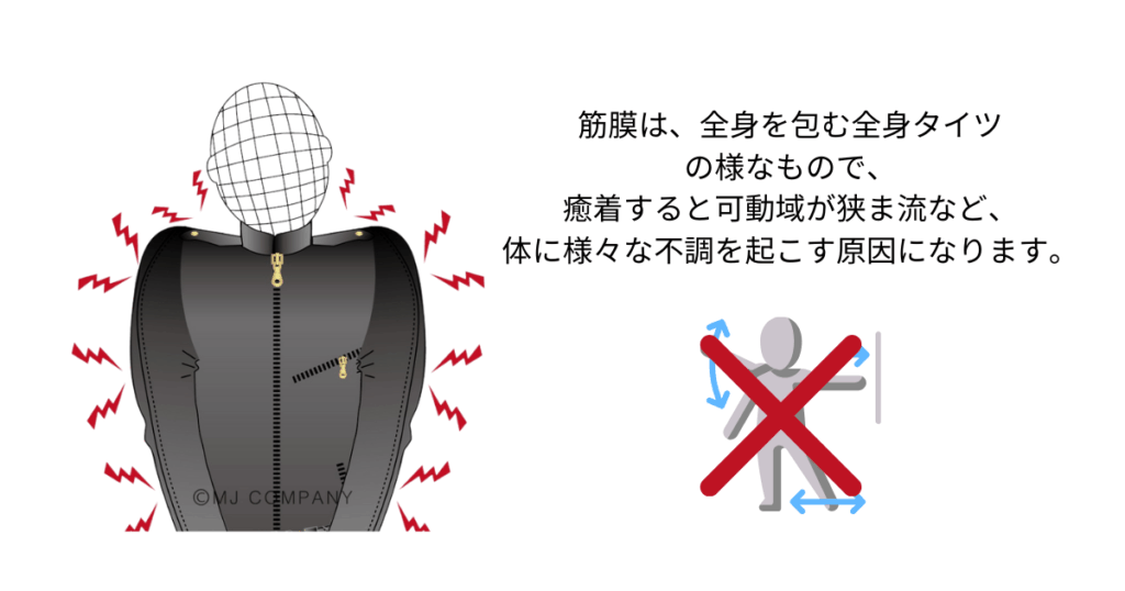 可動域